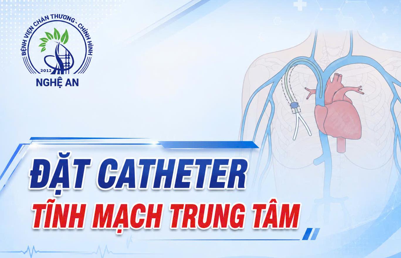 Đặt Catheter tĩnh mạch trung tâm - Thủ thuật quan trọng trong điều trị và hồi sức người bệnh 