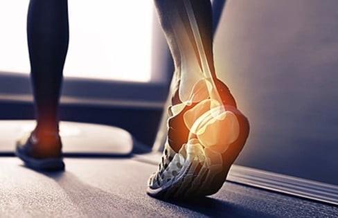 Đứt gân gót chân Achilles: Nguyên nhân, triệu chứng và điều trị 
